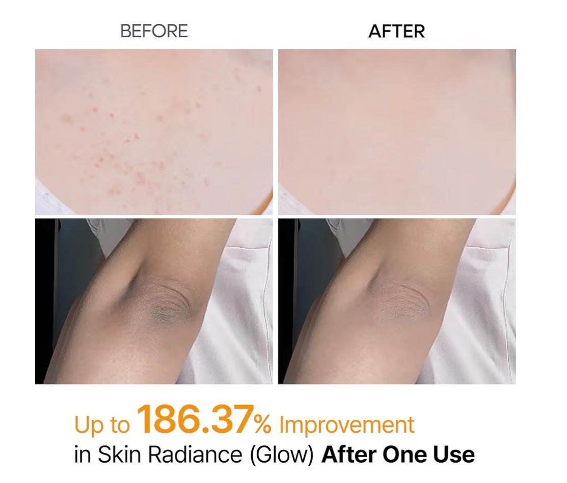 PEEL SHOT DR. MELAXIN ACIDO KOJICO Y CURCUMA