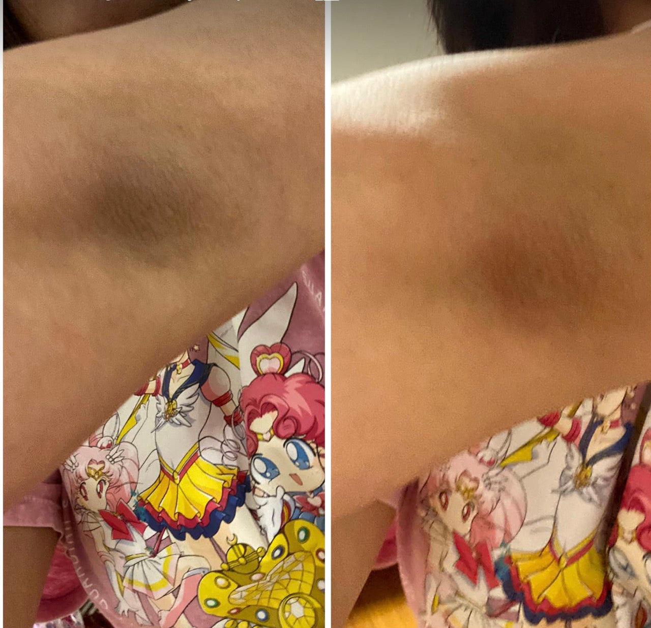 PEEL SHOT DR. MELAXIN ACIDO KOJICO Y CURCUMA