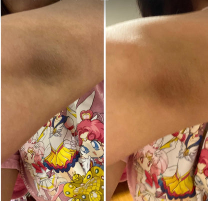 PEEL SHOT DR. MELAXIN ACIDO KOJICO Y CURCUMA