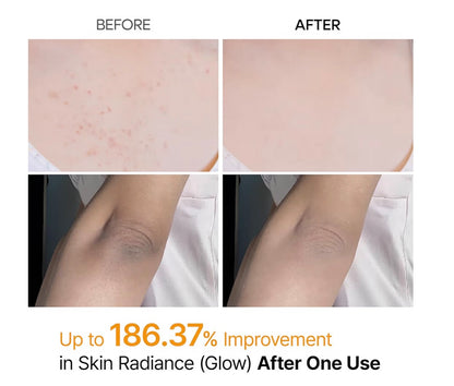 PEEL SHOT DR. MELAXIN ACIDO KOJICO Y CURCUMA