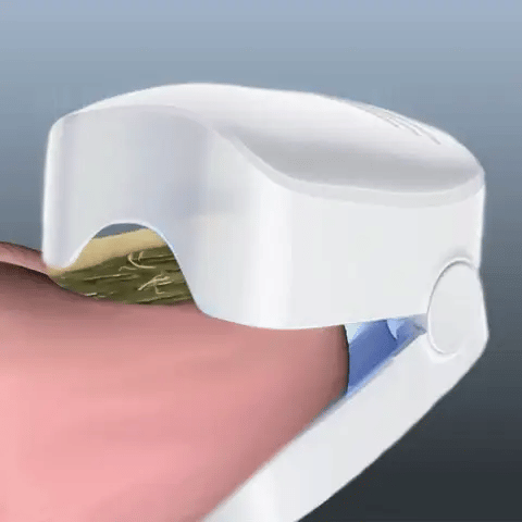 LÁSER PARA HONGOS EN LAS UÑAS