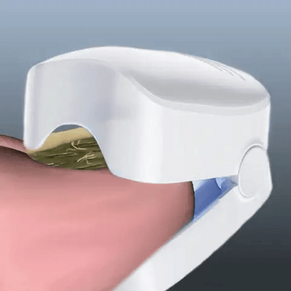 LÁSER PARA HONGOS EN LAS UÑAS