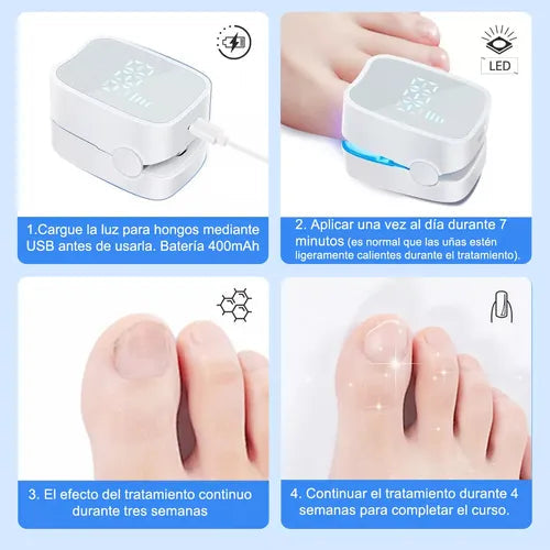 LÁSER PARA HONGOS EN LAS UÑAS