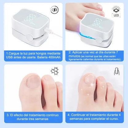 LÁSER PARA HONGOS EN LAS UÑAS